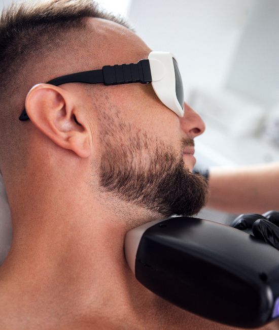 laser masculino